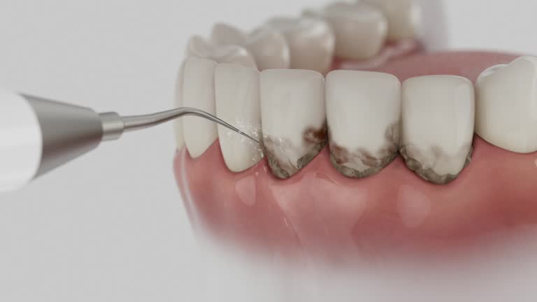 Reliable Root Canal Treatment contractor in Ashtabula County County, OH by Dentist Open Now